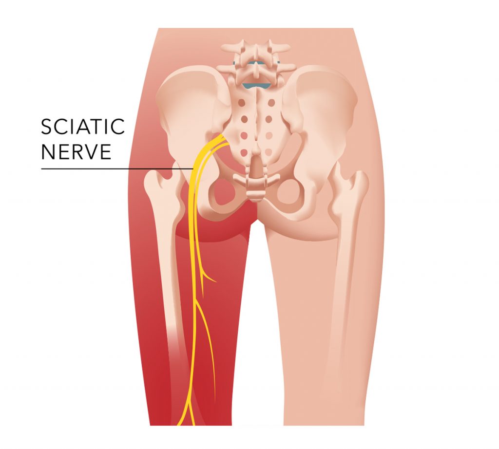 Sciatic Nerve