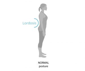 Lordosis - Normal Posture